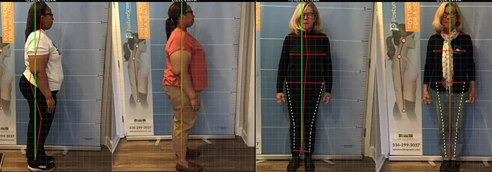 Chiropractic Greensboro NC Before And After